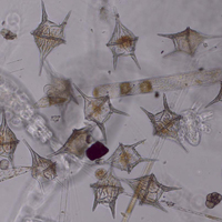 Datei:Phytoplankton Ceratium.jpg