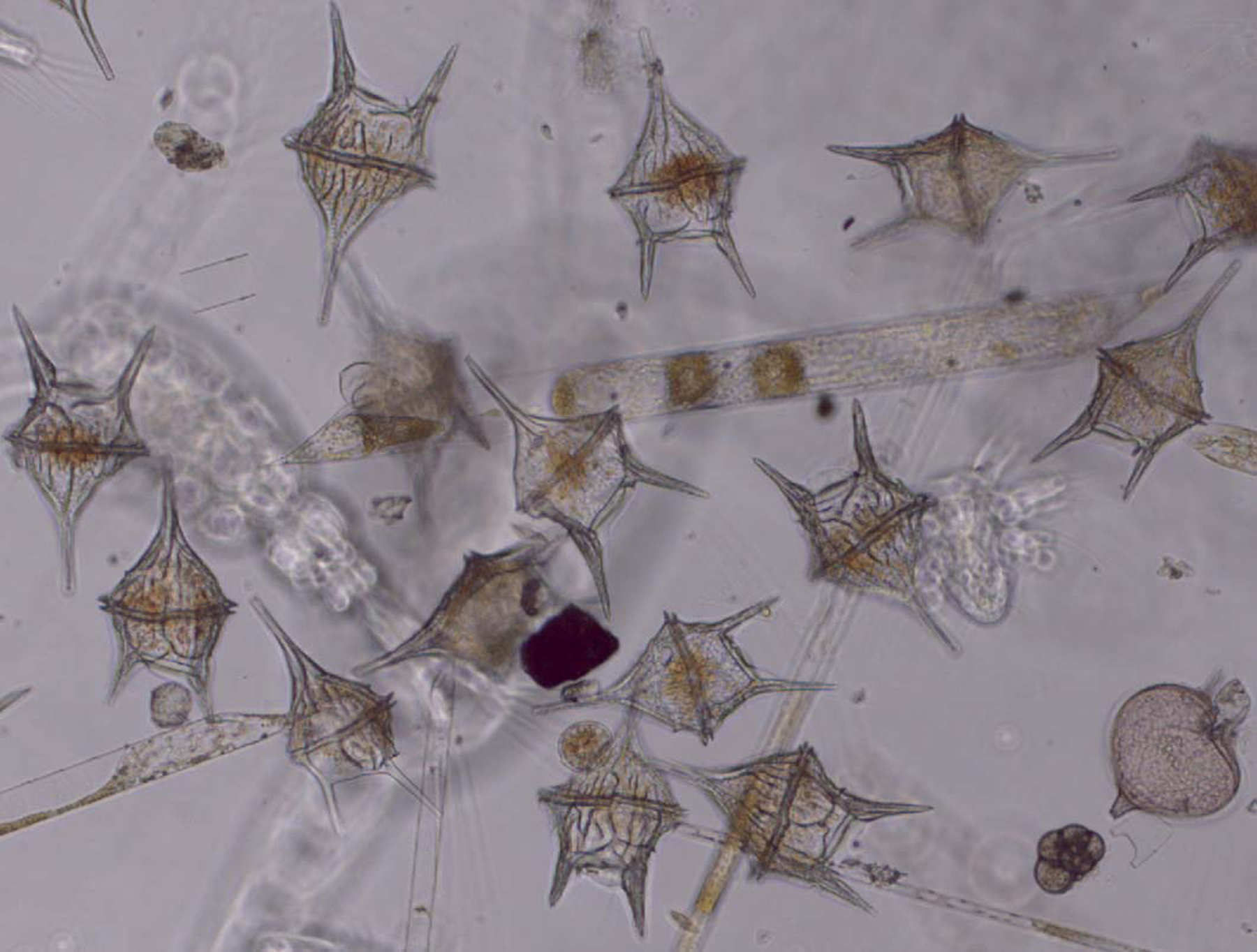 Фитопланктон группа. Ceratium hirundinella цикл. Фитопланктон. Диатомовый планктон под микроскопом. Фитопланктон под микроскопом.