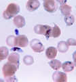 Plasmodium falciparum Malaria-Erreger Lizenz: public domain